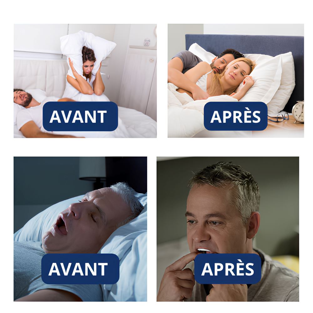 Orthèse dentaire Snoozia Pro UNISSEX - SAUDE - SNOOZIA PRO Mascato Shop